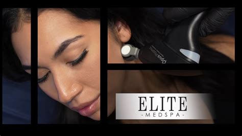 Elite medspa. Services — Elite Medspa. Book Appointment. Offering non-invasive facial rejuvenation and body contouring. to meet your individual goals. Facial Rejuvenation | Body Contouring | Injectables | Facials | Sauna. Achieve … 