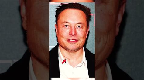 Elon musk neck scar. Things To Know About Elon musk neck scar. 