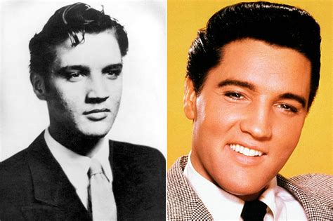 Elvis nose job. 1. After Elvis Presley Plastic Surgery Before And After Photos, quickly return to normal life; 2. Save the plastic result for a long time. In both cases, use the techniques of natural rejuvenation and combine them with Elvis Presley Plastic Surgery Before And After Photos. If for any reason you can not use plastic surgery, then natural methods ... 