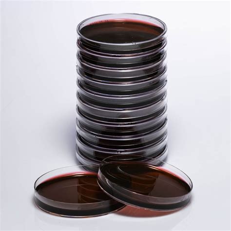 Emb Besiyeri Ne Demek –.