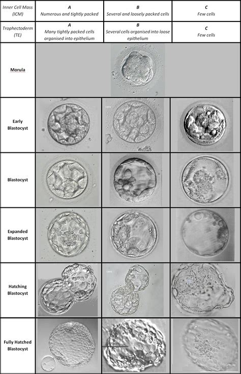 Embryo Grading & How It