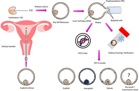 Embryo Selection with PGTA IVF Testing of Embryos