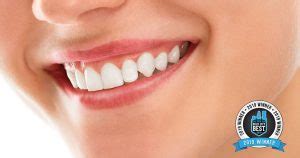 Emergency Dentist Jacksonville, 32277 Arlington Dental Center