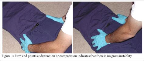 Emergent management of the suspected pelvic fracture: …