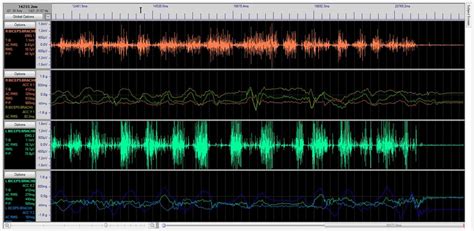 Emgworks acquisition manual.  Includes EMGworks Acquisition, EMGworks ...
