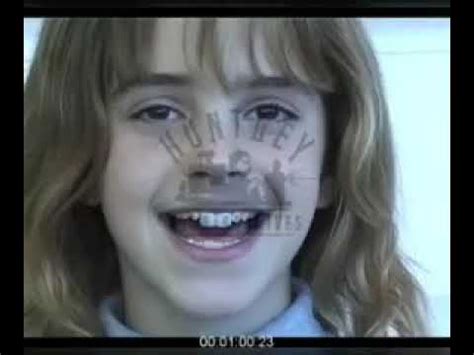 Emma Watson Teeth Test/Teeth in Hermione Granger Harry Potter …