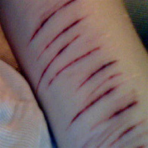 Emo cuts on their legs. .  ...
