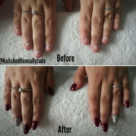 EMUAIDMAX® Kills Nail Fungus 99% of Bacteria is Eliminated in Less than One Minute. Made With Natural Ingredients. Dermatologist Tested & Non-Irritating Formula. 30 Day Money-Back Guarantee. Get Noticeable Improvement within 24 Hours!. 