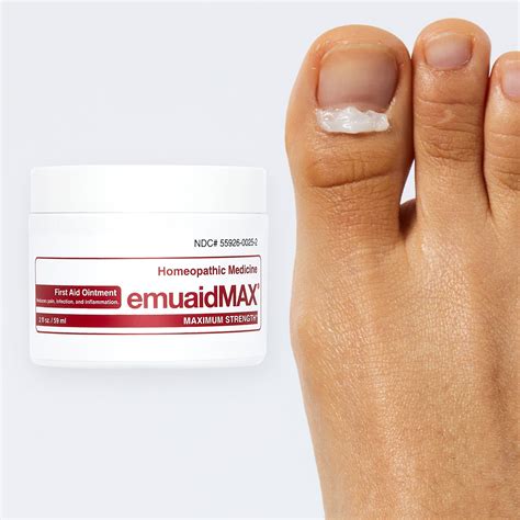 How to Identify Toenail Fungus and When to Use Emuaid. Toenail fungus, also known as onychomycosis, is a common condition that affects the toenails and can cause discoloration, thickening, and crumbling of the nail. It is caused by a fungal infection that can be difficult to treat.. 