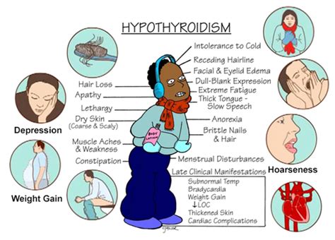 Too much antidiuretic hormone (ADH) DI Manifestations. - Polyuria - Urine output 5-20 L/day. - Polydipsia - Drinking 4-30 L/day. - Dehydration - Poor skin turgor, dry mucous membranes, hypotension, tachycardia, wt. loss, headache, dizziness, constipation. - Hypovolemic shock - hypotension, tachycardia, decreased CO, decreased cerebral perfusion.. 