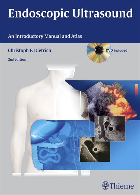 Endoscopic ultrasound an introductory manual and atlas 2nd edition. - Dokumentation der konferenz europäischer arbeitsmarkt, grenzenlos mobil?.