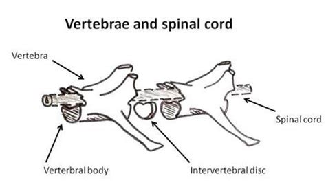 English Bulldog - Hemivertebrae - UFAW