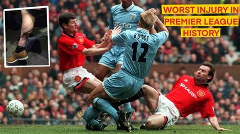 English Premier League: The 10 Worst Injuries in History