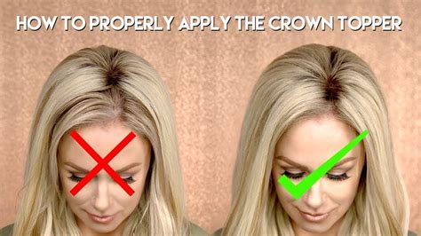 Enhance Your Crown with the Revolutionary Crown Topper for Hair