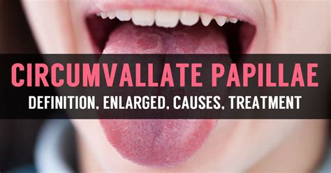 Enlarged Circumvallate Papillae Pictures, Causes, Treatment, Cancer