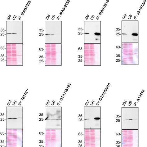 Entry - *610899 - CHARGED MULTIVESICULAR BODY PROTEIN 4C; CHMP4C …