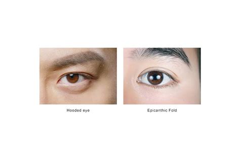 What are epicanthic folds? This eye/crease shape is quite common among Asian people, like myself. Ever wondered how your crease would affect the kind of eye .... 