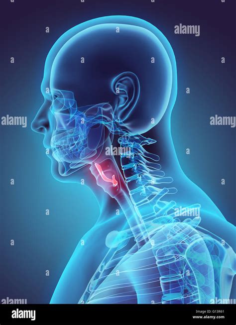 Epiglottis hi-res stock photography and images - Alamy