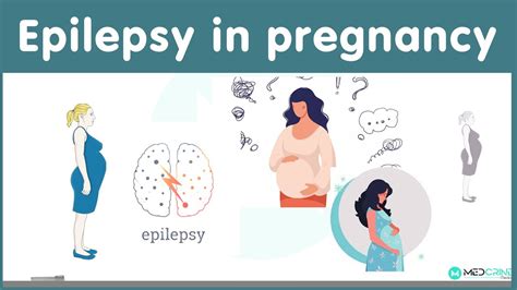 Epilepsy in Pregnancy