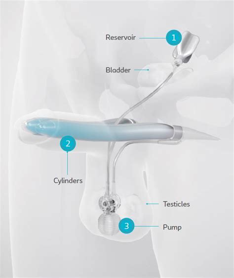 Erectile Dysfunction Surgery Pump ：young Girls Love Big Cocks