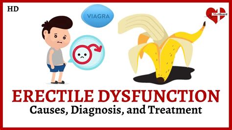 N52.9: Male Erectile Dysfunction, Unspecified