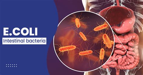 Escherichia coli in infants