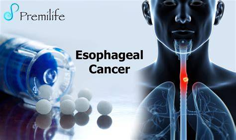Esophageal Cancer