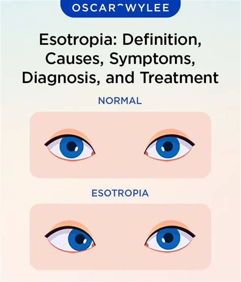 Esotropia: Different Types, Symptoms, Causes, and When to See a …