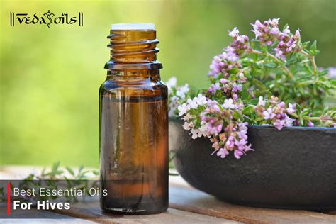 Essential Oils for Hives Best Natural Oils for Itchy Hives - VedaOils