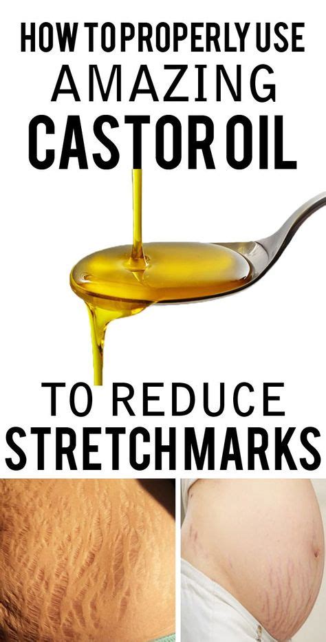 Essential oils for stretch marks: The 8 best oils to get rid of them fast