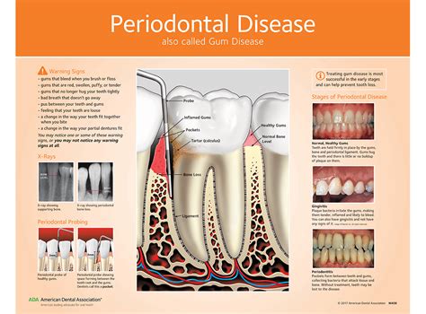 Essential periodontal therapy a patient 146 s guide to understanding. - Pioneer ct f9191 manuale di servizio.