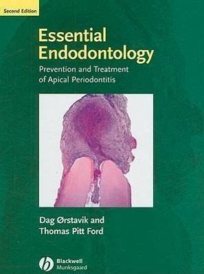 Download Essential Endodontology Prevention And Treatment Of Apical Periodontitis By Dag Grstavik