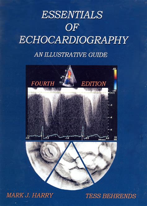 Essentials of echocardiography and cardiac hemodynamics an illustrative guide second edition. - La gestión de los recursos hídricos.