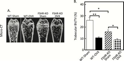 Estrogen Versus FSH Effects on Bone Metabolism: Evidence From ...