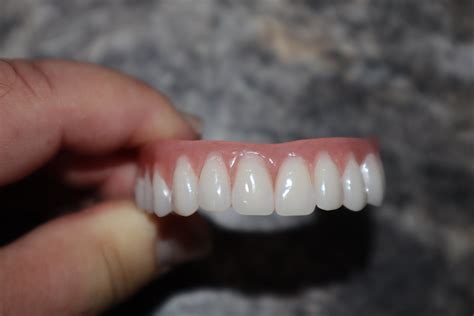 Dental AcryHard Denture Reline Resin - Self-Cured Emergency Acrylic Hard Liner Kit for DIY Home-Use Repair & Renew. CA$86.93. Check out our used dentures selection for the very best in unique or custom, handmade pieces from our oral care shops.. 
