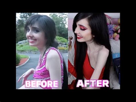 Eugenia cooney before and after rehab. I've noticed some groups say that Eugenia is triggering and her photos promote eating disorders and self harm. Yet those same images are shared in reddit groups which further harm the audience people are concerned for. Furthermore, the before and after shots which show Euegnia's decline may cause people to spiral further into their own EDs. 