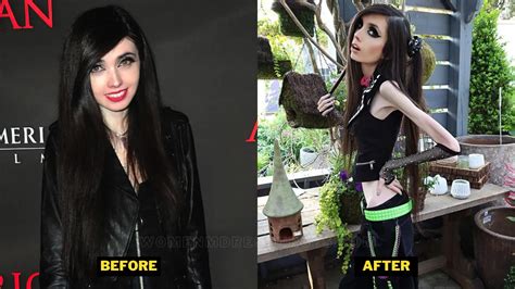  Not to mention that “before and after” obsessions are exactly what she would like. In eating disorders there’s always an intense desire to be seen as “different” than before, since losing weight is “progress.”. I really like the focus on the “conventional beauty standard”. It’s a shame. . 