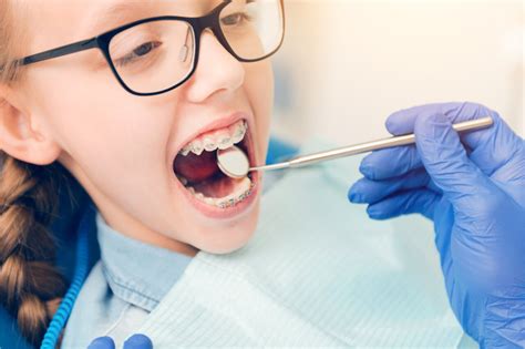 Everything you need to know about orthodontic treatment an experts guide with answers to frequently asked questions. - The johns hopkins medical guide to health after 50.