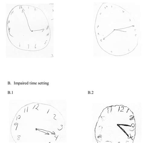 Examples of Clock Drawing. * Note The patient in example A1 was asked