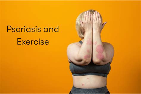 Exercise and psoriasis Links and more