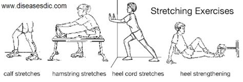 Exercises and Stretches for Sever