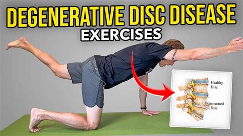 Exercises to avoid with degenerative disk disease