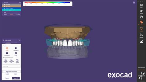 Exocad denture.  Fewer failed prints.  Our software handles complex cases with ease, ensuri...