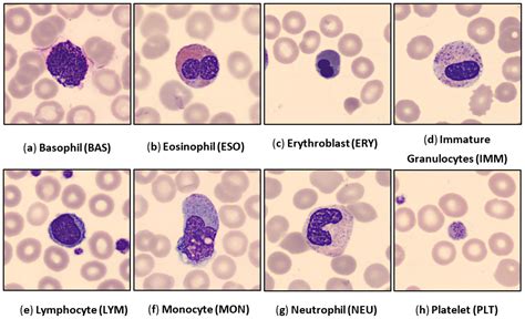 Expression of eosinophil peroxidase in the immature basophil cell …