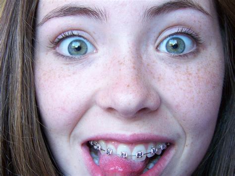 Extremely cute teen with braces naked. .  ...