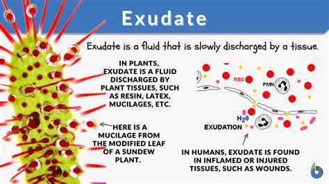 Exudates Definition & Meaning - Merriam-Webster