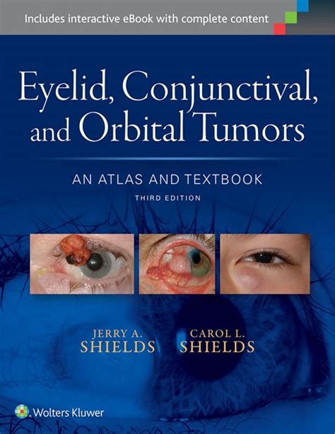 Eyelid conjunctival and orbital tumors an atlas and textbook. - Four winds five thousand motorhome manual.