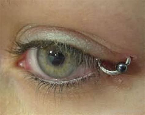 Eyelid pierced. Things To Know About Eyelid pierced. 