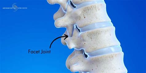 Facet - muktibox.com
