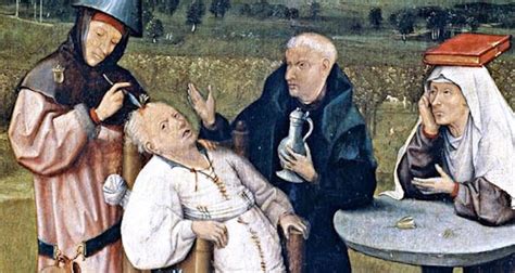 Facts and Myths of Primitive Trepanations | Springer Nature Link - wintechmobiles.com